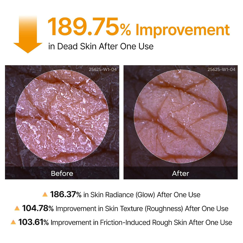 Dr.Melaxin Peel Shot Kojic Acid Turmeric Body Exfoliator Spray 6.76 fl.oz - AHA PHA Niacinamide Body Scrub for KP Bumps, Dark Spots, Uneven Skin Tone, Dead Skin, Korean Skin Care