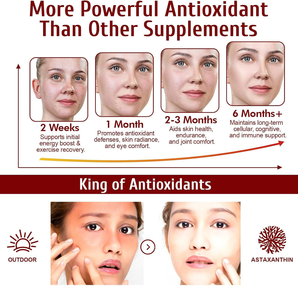 Astaxanthin 12mg, 120 Softgels, 4 Month Supply, Premium Astaxanthin Antioxidant Supplements with Antioxidant Activity, Supports Eye, Immune, Joint, Skin Health, Internal Circulation
