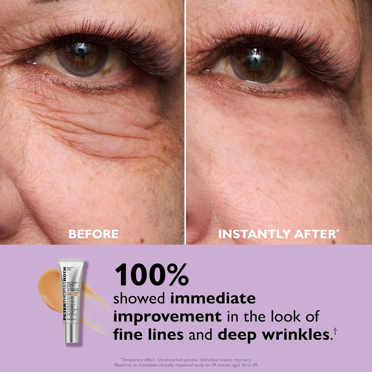 Peter Thomas Roth | Instant FIRMx® Eye Temporary Eye Tightener Easy-Wear Formula | For Firming Under-Eye Bags & Wrinkles