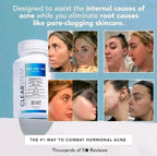 CLEARSTEM - MIND, BODY, SKIN Hormonal Acne Supplement 5-HTP Natural DIM 90 Count