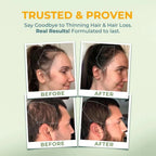 VITAL NUTRITIVE Vital Hair Complex – Biotin & Vitamin B Hair Vitamins for Wom...