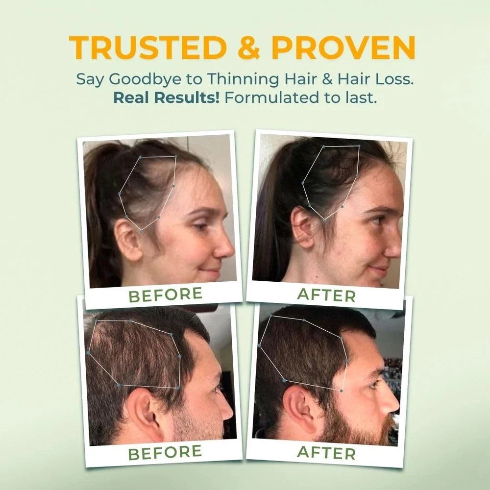 VITAL NUTRITIVE Vital Hair Complex – Biotin & Vitamin B Hair Vitamins for Wom...